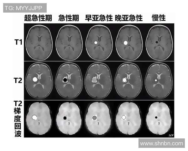 冰球联赛恶意犯规趋势与处罚机制演变的分析与思考